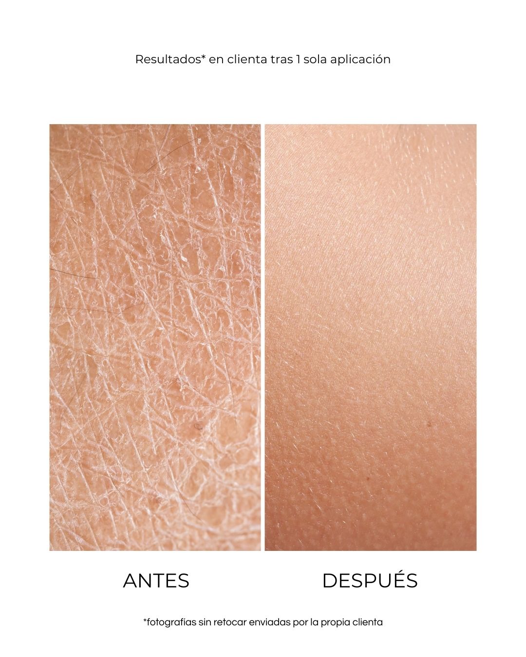 Crema Corporal
