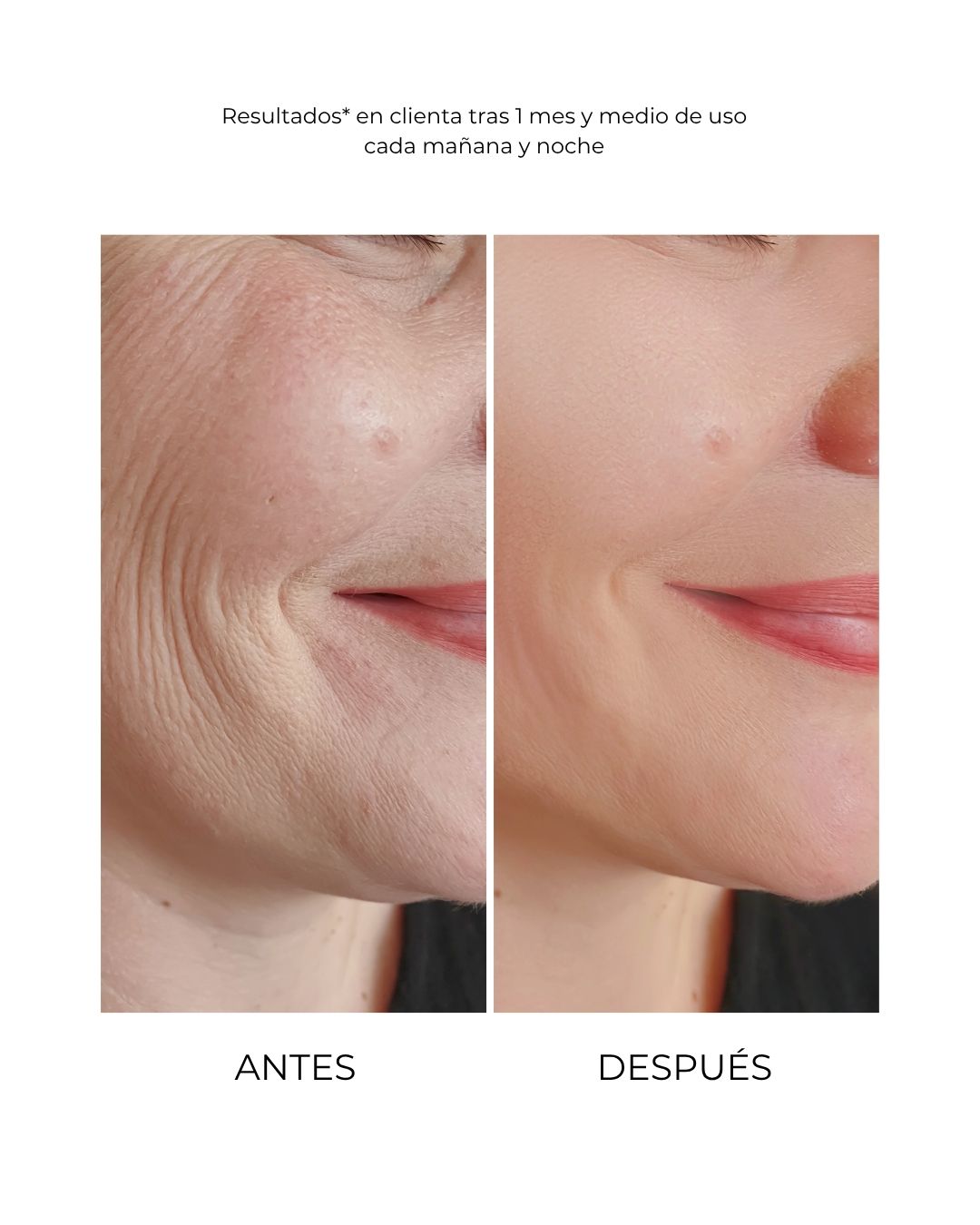 Antiox and Regenerative Treatment