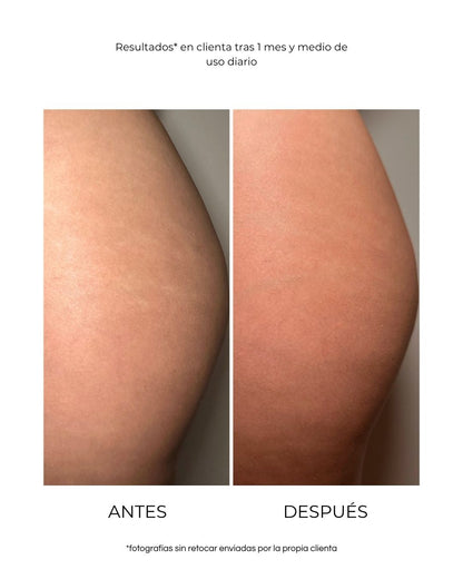Aceite Corporal Antiestrías y Nutritivo 100ml